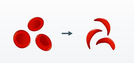 sickle-cell-disease-india-achieved-the-target-of-6-crore-tests-government-informed